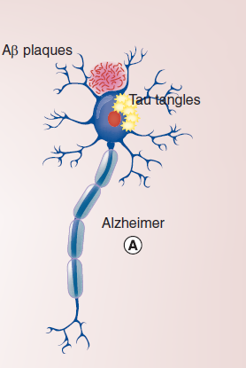 تصویر نورون‌‌های مرتبط با بیماری آلزایمر
