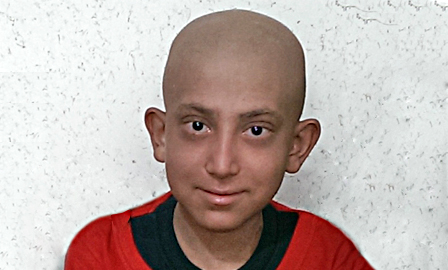 زندگی دوباره امیرحسن با سلول ه...