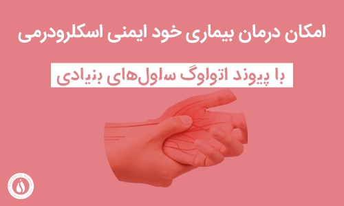 پیوند اتولوگ  سلول‌های بنیادی ...