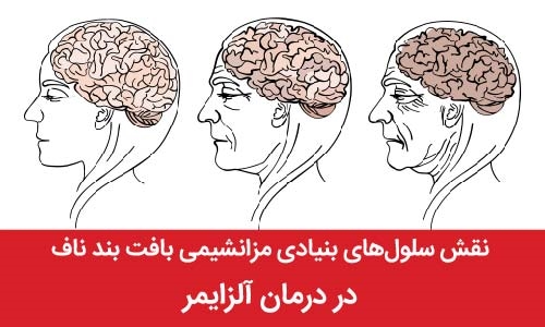 نقش سلول‌های بنیادی مزانشیمی ب...