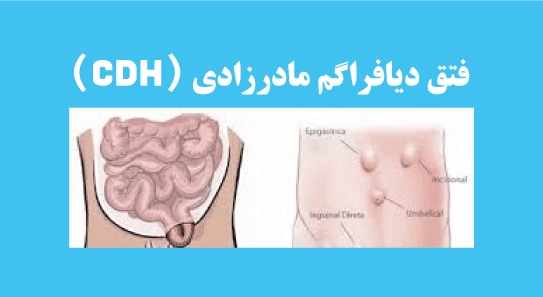 استفاده از ضمائم زایمانی در در...
